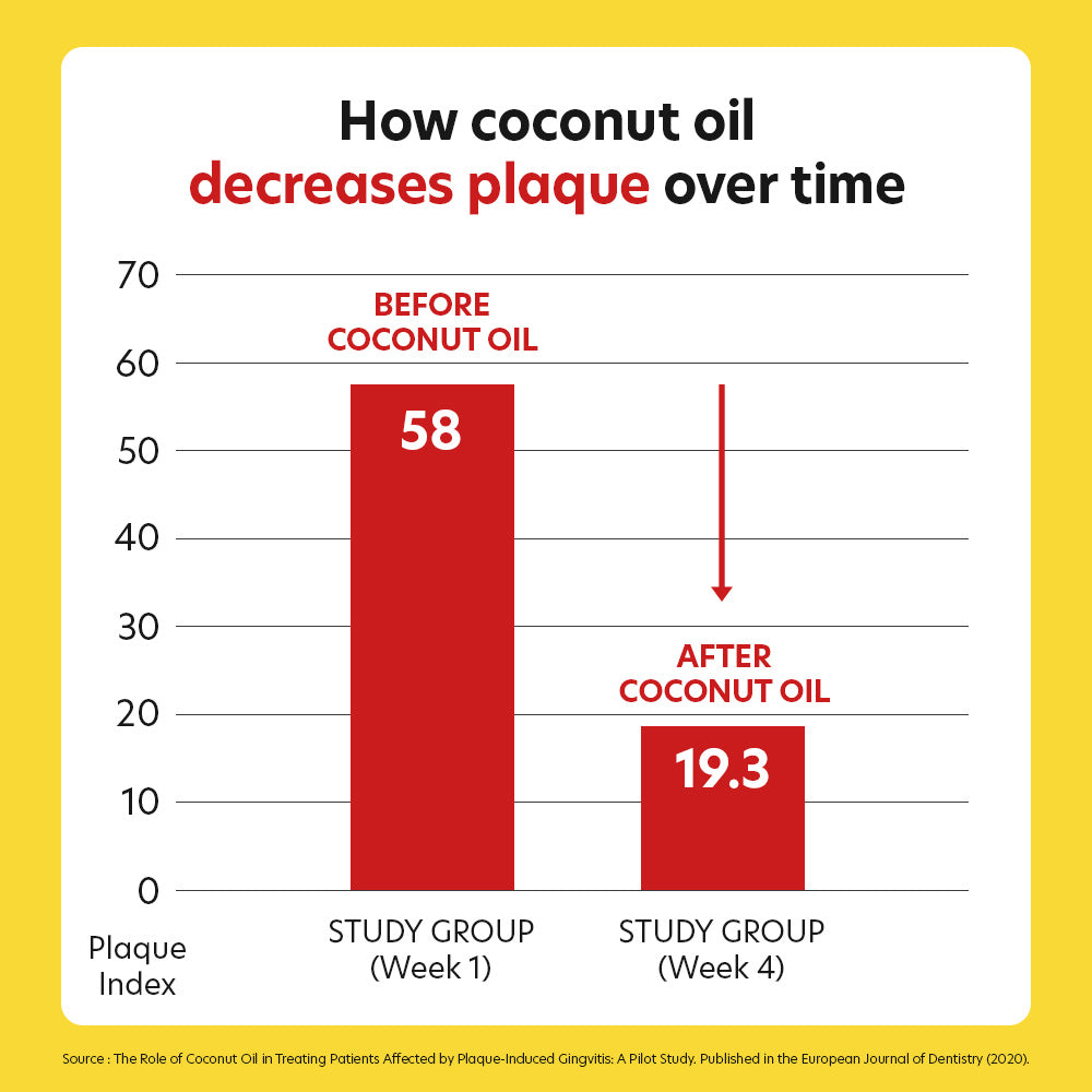 Dental Chews Banana - Digestive Support