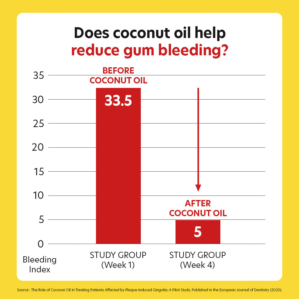 Dental Chews Banana - Digestive Support