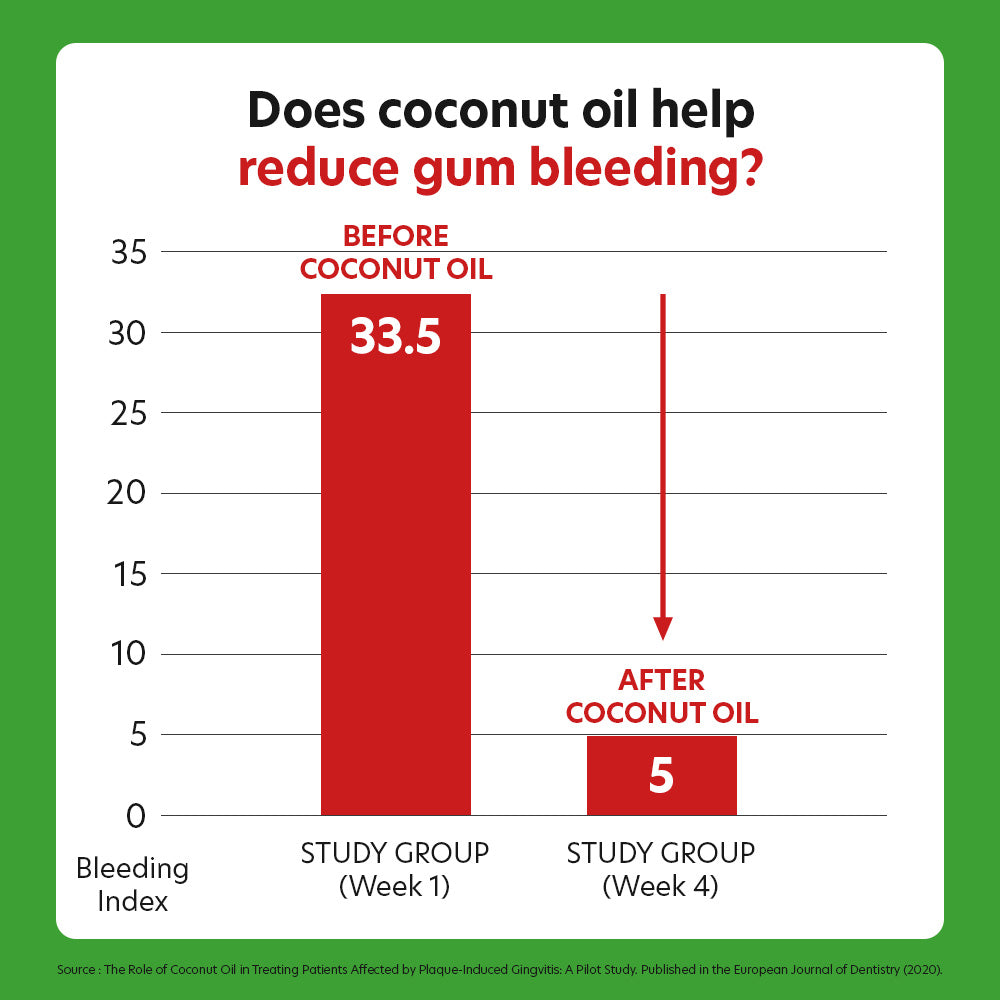 Dental Chews Seaweed - Immune Support